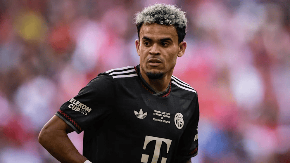 场球衣基本, 黑首次在自